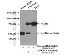 ANKS1B Antibody in Immunoprecipitation (IP)