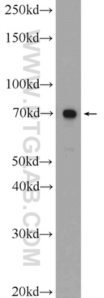 ANKS1B Antibody in Western Blot (WB)