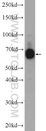 ANKS1B Antibody in Western Blot (WB)