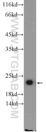 TMEM35 Antibody in Western Blot (WB)