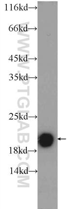 TMEM35 Antibody in Western Blot (WB)