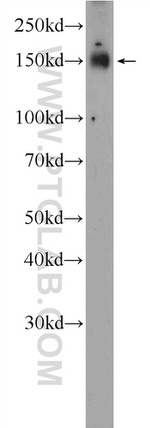 PHF14 Antibody in Western Blot (WB)