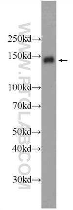 PHF14 Antibody in Western Blot (WB)