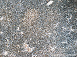 NALP1 Antibody in Immunohistochemistry (Paraffin) (IHC (P))