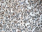 NALP1 Antibody in Immunohistochemistry (Paraffin) (IHC (P))