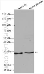 C15orf29 Antibody in Western Blot (WB)