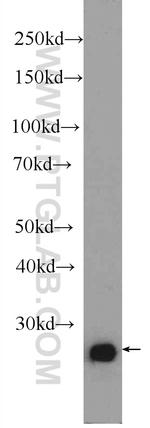 C15orf29 Antibody in Western Blot (WB)