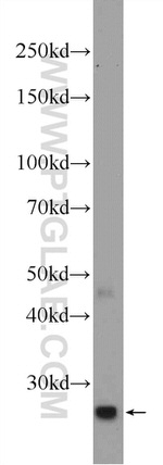 C15orf29 Antibody in Western Blot (WB)