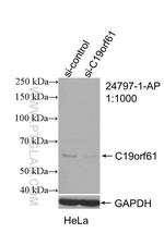 C19orf61 Antibody in Western Blot (WB)