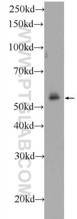 C19orf61 Antibody in Western Blot (WB)
