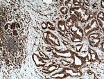 TMEM179 Antibody in Immunohistochemistry (Paraffin) (IHC (P))