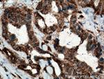 TMEM179 Antibody in Immunohistochemistry (Paraffin) (IHC (P))
