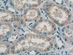 PXMP2 Antibody in Immunohistochemistry (Paraffin) (IHC (P))