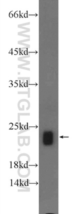 PXMP2 Antibody in Western Blot (WB)