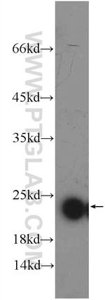 PXMP2 Antibody in Western Blot (WB)