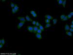 FAM92A1 Antibody in Immunocytochemistry (ICC/IF)