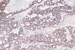 STEAP2 Antibody in Immunohistochemistry (Paraffin) (IHC (P))