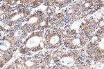 STEAP2 Antibody in Immunohistochemistry (Paraffin) (IHC (P))