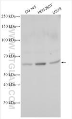 STEAP2 Antibody in Western Blot (WB)