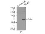 ZNF391 Antibody in Immunoprecipitation (IP)