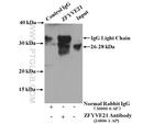 ZFYVE21 Antibody in Immunoprecipitation (IP)