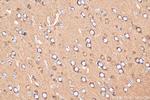 NPTXR Antibody in Immunohistochemistry (Paraffin) (IHC (P))