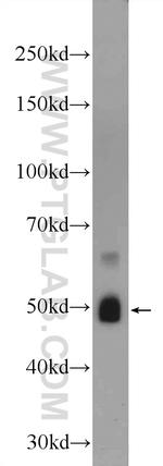 ZRANB2 Antibody in Western Blot (WB)