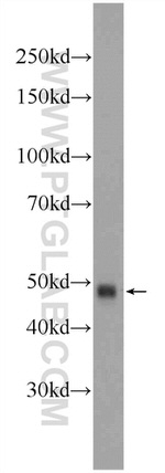 ZRANB2 Antibody in Western Blot (WB)