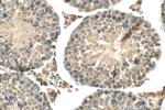 USP50 Antibody in Immunohistochemistry (Paraffin) (IHC (P))