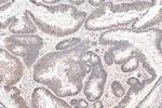 INO80 Antibody in Immunohistochemistry (Paraffin) (IHC (P))
