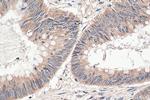 INO80 Antibody in Immunohistochemistry (Paraffin) (IHC (P))