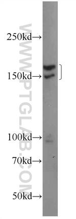 INO80 Antibody in Western Blot (WB)