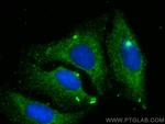 C1RL Antibody in Immunocytochemistry (ICC/IF)