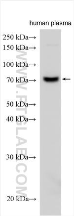 C1RL Antibody in Western Blot (WB)