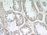 ATXN2L Antibody in Immunohistochemistry (Paraffin) (IHC (P))