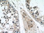 ATXN2L Antibody in Immunohistochemistry (Paraffin) (IHC (P))