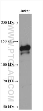 ATXN2L Antibody in Western Blot (WB)