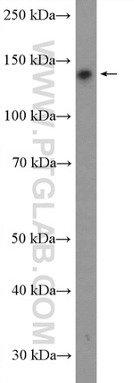 ATXN2L Antibody in Western Blot (WB)
