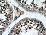 ZNF658 Antibody in Immunohistochemistry (Paraffin) (IHC (P))