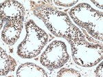 ZNF658 Antibody in Immunohistochemistry (Paraffin) (IHC (P))