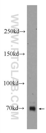 ZNF658 Antibody in Western Blot (WB)