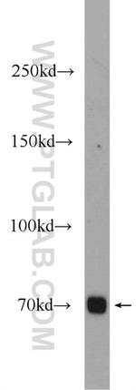 ZNF658 Antibody in Western Blot (WB)