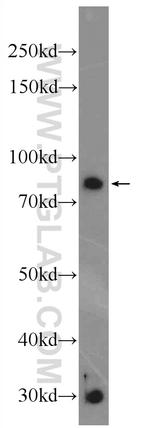 Vertnin Antibody in Western Blot (WB)