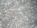 CD20 Antibody in Immunohistochemistry (Paraffin) (IHC (P))