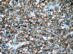 CD20 Antibody in Immunohistochemistry (Paraffin) (IHC (P))
