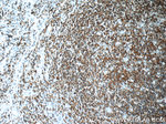 CD20 Antibody in Immunohistochemistry (Paraffin) (IHC (P))