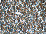 CD20 Antibody in Immunohistochemistry (Paraffin) (IHC (P))