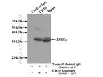 CD20 Antibody in Immunoprecipitation (IP)