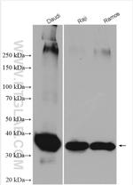 CD20 Antibody in Western Blot (WB)