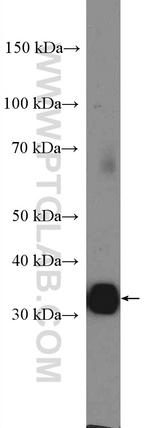 CD20 Antibody in Western Blot (WB)